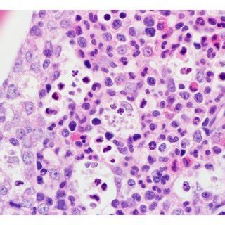 Distinct histologic features of macrophages containing other cell... | Download Scientific Diagram