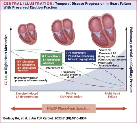 Heart Failure With Preserved Ejection Fraction: JACC Scientific Statement (2023)