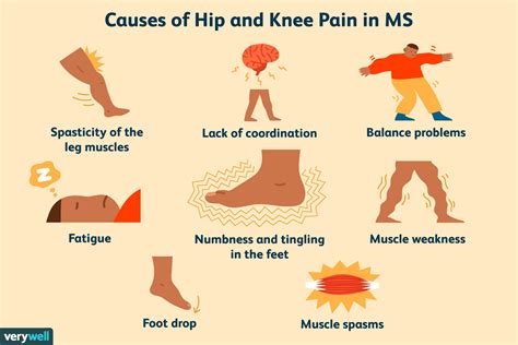 Hip and Knee Pain in Multiple Sclerosis