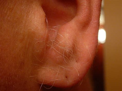 File:Ear hair.jpg - Wikimedia Commons