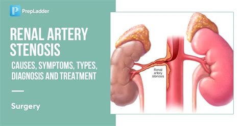 Renal Artery Stenosis: Causes, Symptoms, Risk Factors, Diagnosis, Treatment and Complications