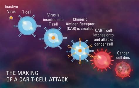 CAR-T-Cell- therapy in India - CancerFax