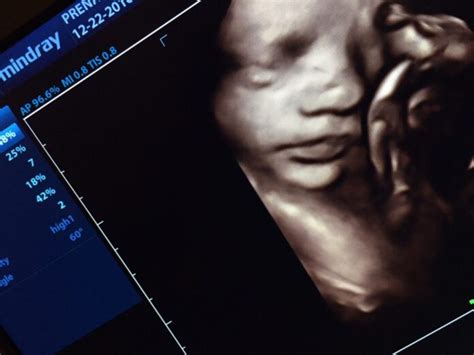 4 Tips for Finding 3D Ultrasound Services Near You - Omnitos