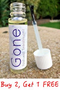 GONE - HYPERPIGMENTATION - Natural Pigmentation Removal Treatment Cream Serum | eBay