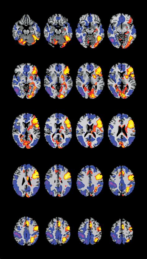 Functional mri - adminpikol