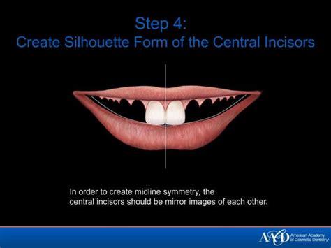 PRINCIPLES OF SMILE DESIGN-DEMYSTIFIED | PPT