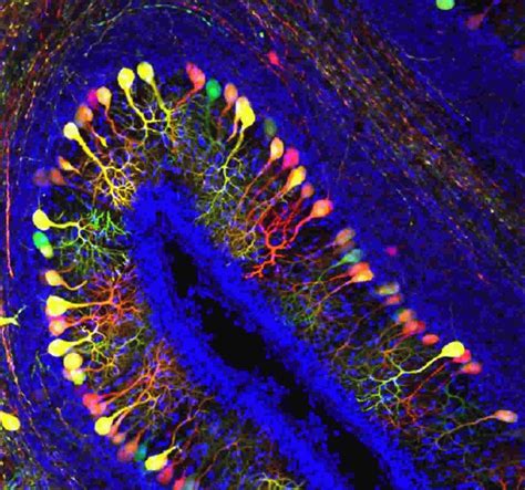 Transporter of Thyroid Hormones is Crucial For Embryonic Brain ...