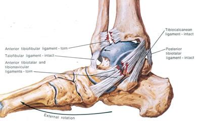 3 Ligaments In Ankle : Ankle Ligaments (All You Need To Know About Your ...