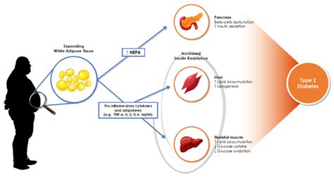 Relationship between obesity and type 2 diabetes | doctorvisit