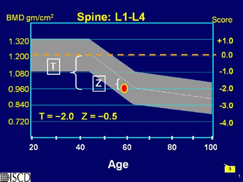 Osteoporosis T Score Chart