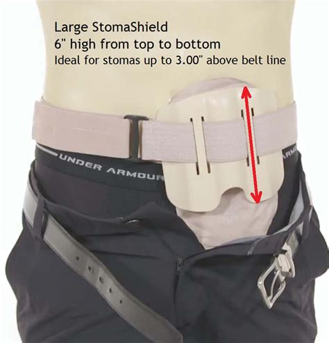 Stoma Guard and Ostomy Support Belt | StomaShield