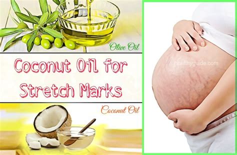 Top 27 Ways To Use Coconut Oil For Stretch Marks On Breasts During Pregnancy