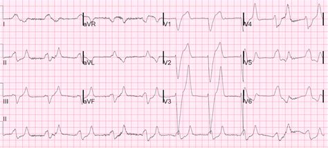 Dr. Smith's ECG Blog