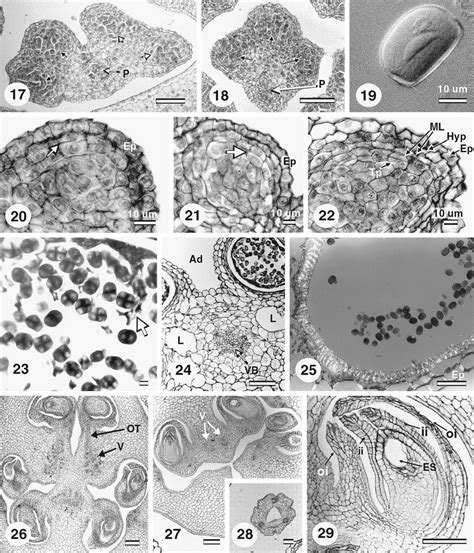 Gynoecium and androecium anatomical and histological development ...