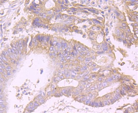 PCSK9 Antibody (MA5-32844)