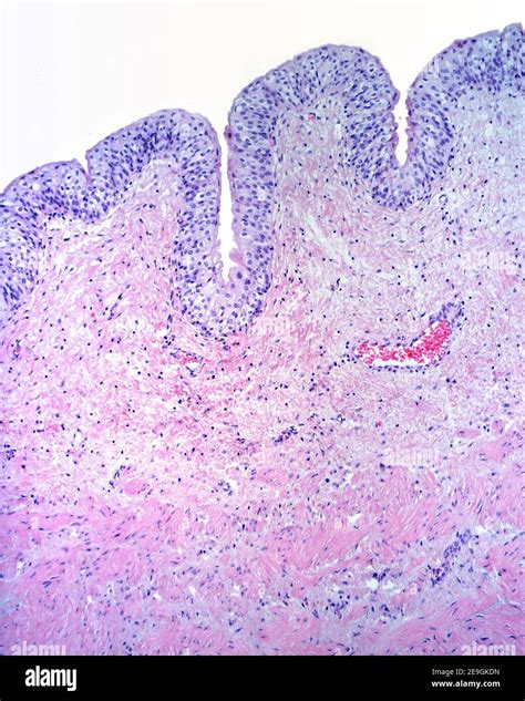 Mucosa of the urinary bladder formed by a transitional epithelium and a ...