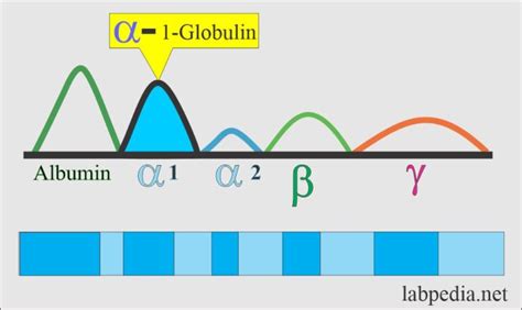 Serum Protein Electrophoresis, Total protein, albumin and globulin - Labpedia.net