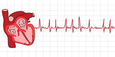 Understanding AFib: A heart dancing without rhythm - Scope