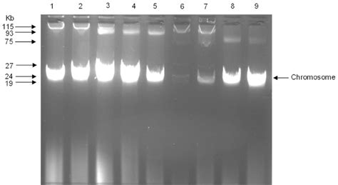 Agarose (1%) gel electrophoresis of plasmid DNA from Escherichia... | Download Scientific Diagram