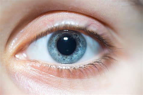 Dilated Pupils: Symptoms, Causes, and Treatment