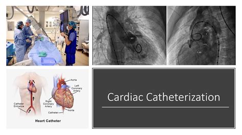 Cardiac Catheterization - YouTube