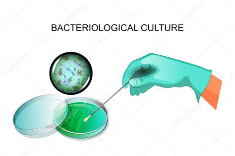 Bacterial inoculation in the laboratory — Stock Vector © Artemida-psy #171949834