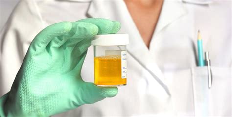 Urine test: why are white blood cells in my urine?