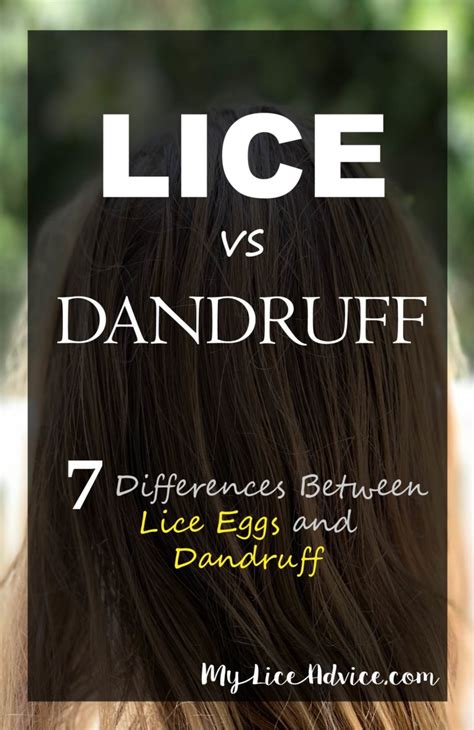 Lice vs Dandruff - 7 Key Differences Between Lice Eggs and Dandruff