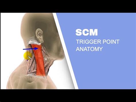 The Best Sternocleidomastoid Stretch (SCM)