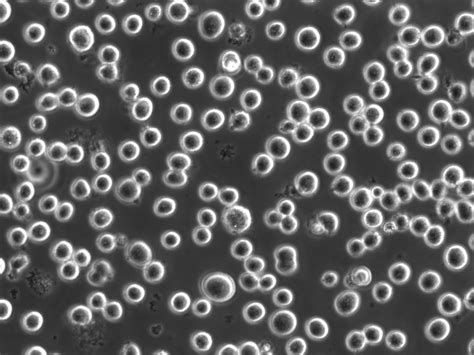 NEPA21 / K562 - Human Erythroleukemia cells - Viability 91 per cent