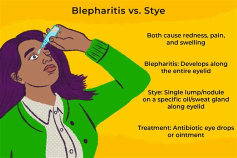 Stye Symptoms Treatment And Prevention