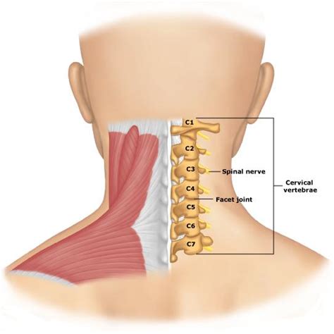 Herniated Disk Neck Surgery - Explanation, Results, Process