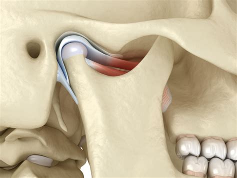 What is TMJ Arthroscopy procedure? | News | Dentagama