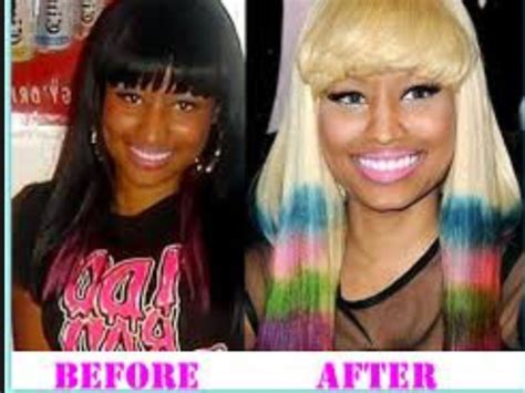 Nikki Minaj before and after | Facial cosmetic surgery, Celebrity plastic surgery, Plastic surgery