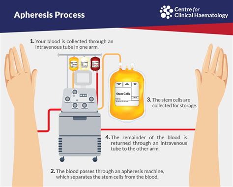 Autologous peripheral blood stem cell transplant | CFCH | Centre for Clinical Haematology