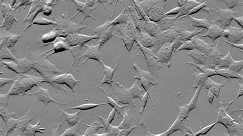 ZEISS Celldiscoverer 7: Brain cells in culture, 72 hours time-lapse ...