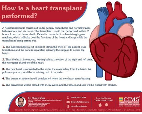 How Is a Heart Transplant Performed ? | The Best Cardiac Surgeon in ...