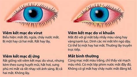 Đau mắt đỏ lây qua đường nào? Cách phòng ngừa bệnh đau mắt đỏ