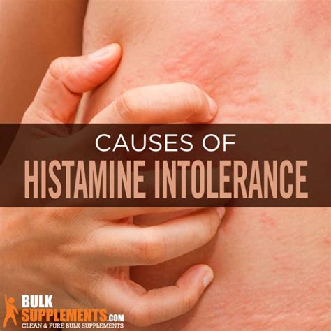 Histamine Intolerance: Signs, Causes & Treatment