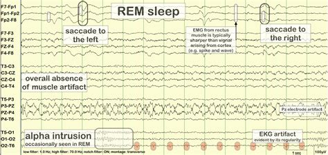 rapid eye movement (REM) sleep