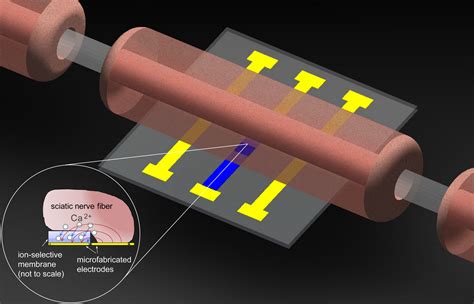 Improved neurostimulators reduce pain | Kurzweil