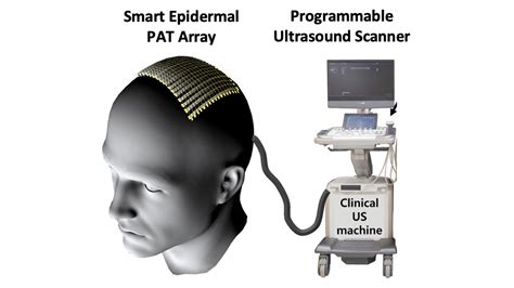 A Non-Invasive Way to Visualize the Deep Brain | Duke Pratt School of ...