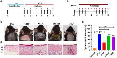 Frontiers | Comparative Study on Different Skin Pruritus Mouse Models