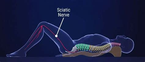 What Causes Sciatic Nerve Pain | FMPM | Pain Management