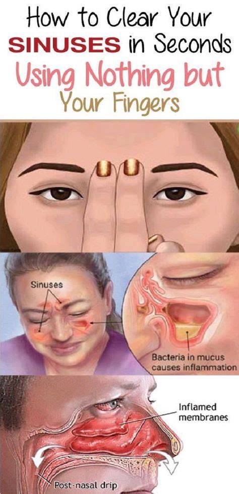 Relieve sinus pressure with this simple trick. Therapist Explains How to Clear Your Sinuses ...