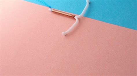 Period After IUD Removal: All You Need To Know!