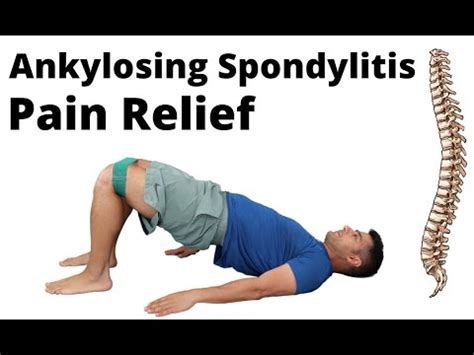 Ankylosing Spondylitis exercises for pain relief - YouTube