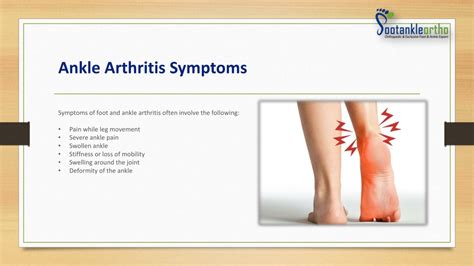 PPT - Ankle Arthritis- Symptoms and Causes - Footankleortho PowerPoint Presentation - ID:11931004