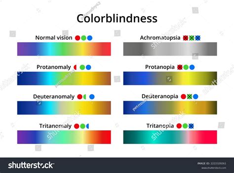 17 Achromatopsia Images, Stock Photos & Vectors | Shutterstock