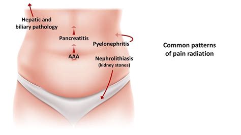 Low Abdominal Pain Left Side